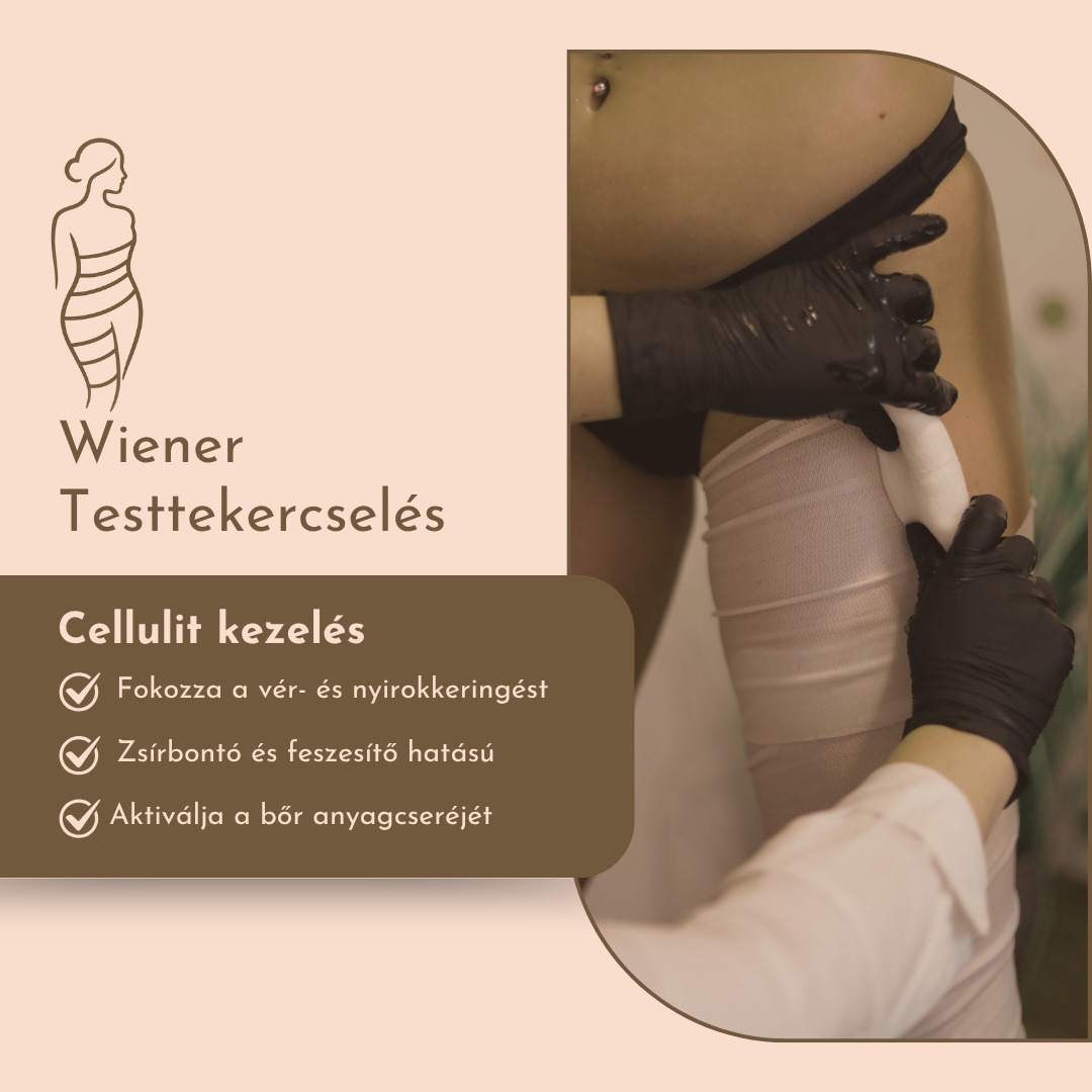 Wiener testtekercselés szakmai választás